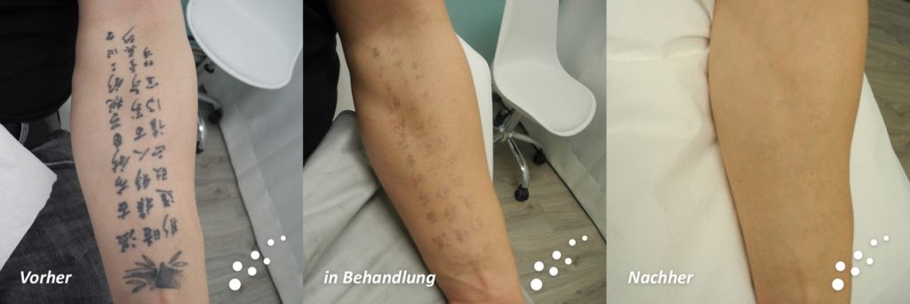 11-behandlungen_2-min-1-1024x342