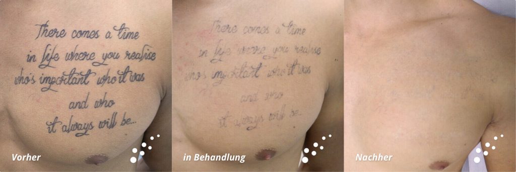 no-22_end_nach_12_behandlungen-1-1024x342